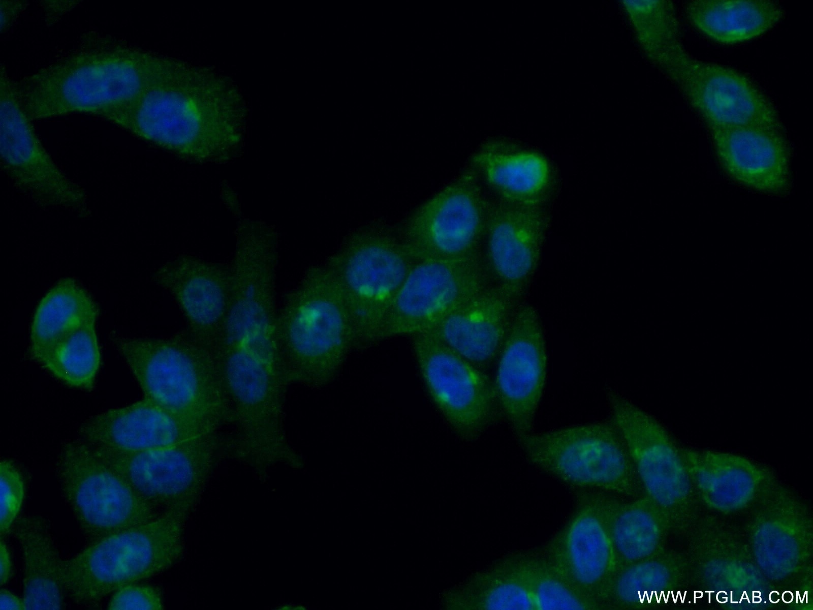 Immunofluorescence (IF) / fluorescent staining of HeLa cells using GS28 Polyclonal antibody (16106-1-AP)