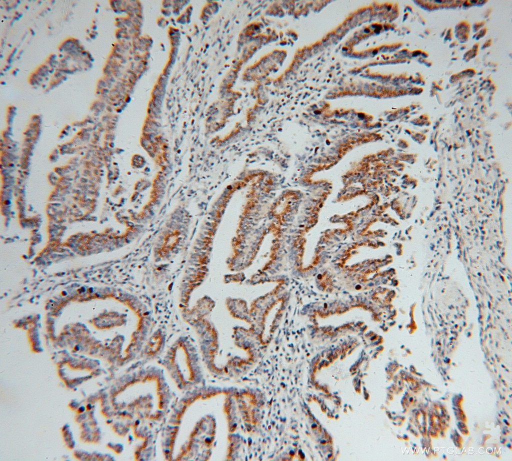 GS28 Polyclonal antibody