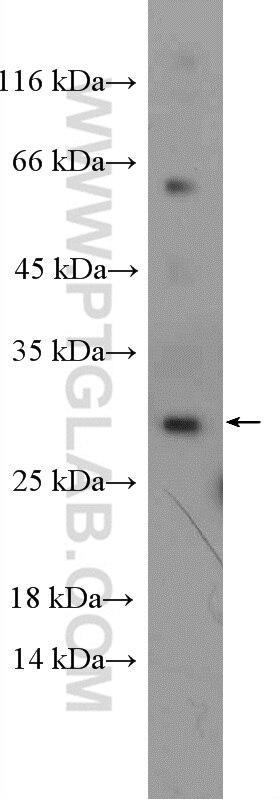 WB analysis of rat liver using 16106-1-AP