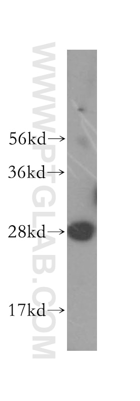 Western Blot (WB) analysis of human liver tissue using GS28 Polyclonal antibody (16106-1-AP)