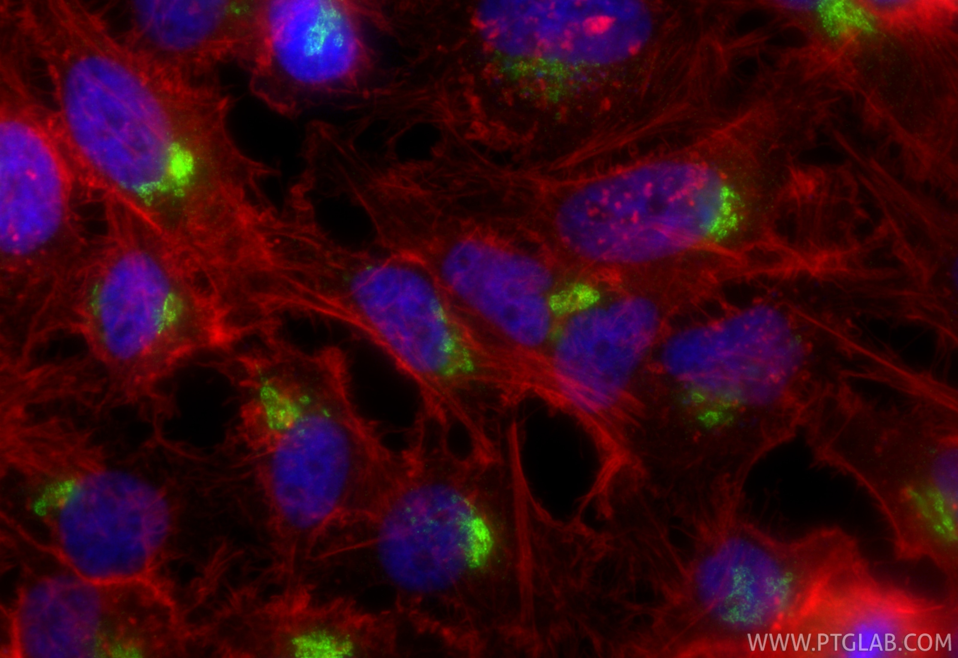 Immunofluorescence (IF) / fluorescent staining of HeLa cells using GS28 Recombinant antibody (84971-3-RR)