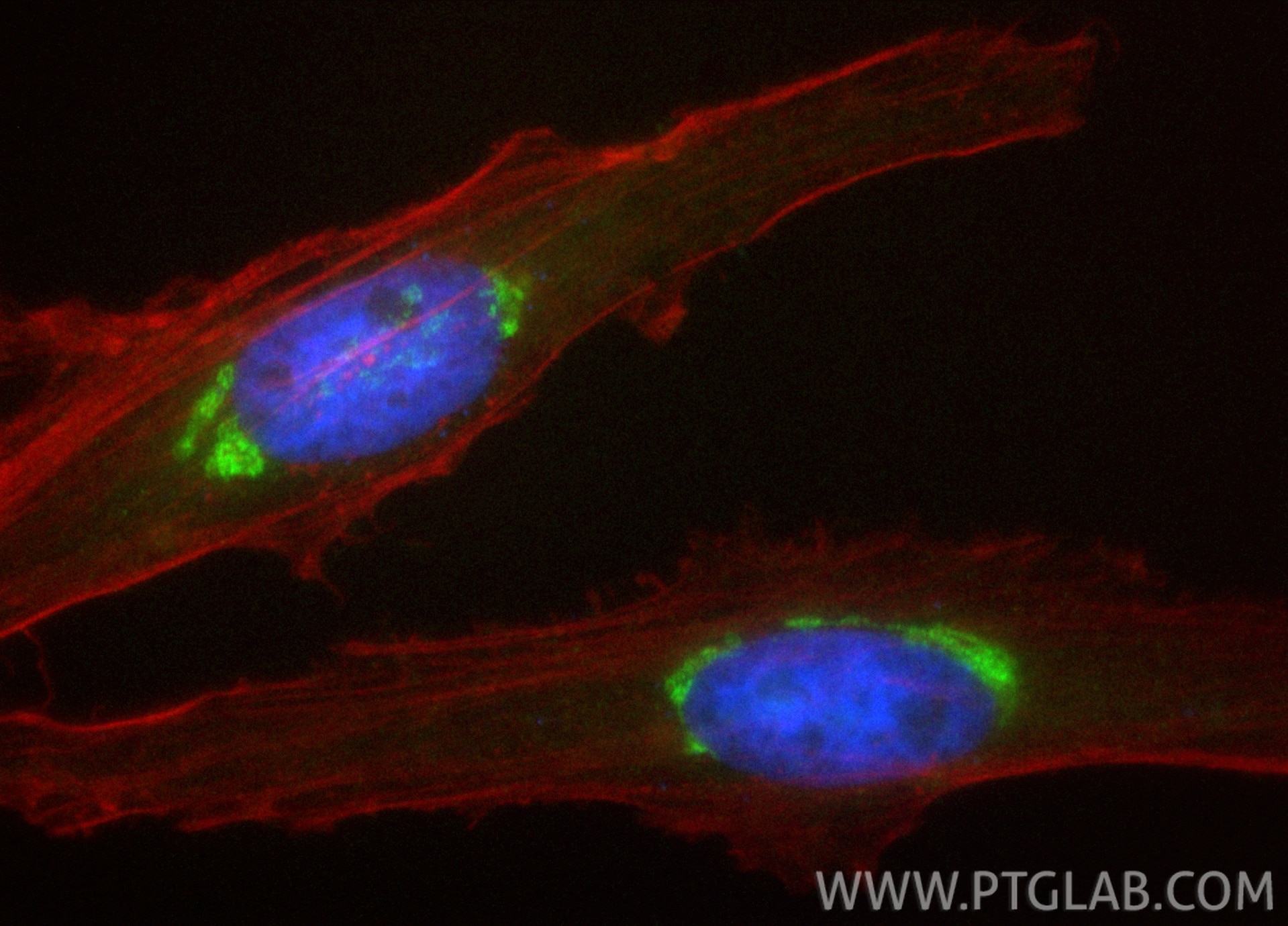 Immunofluorescence (IF) / fluorescent staining of HeLa cells using CoraLite® Plus 488-conjugated GS28 Recombinant ant (CL488-84971-3)