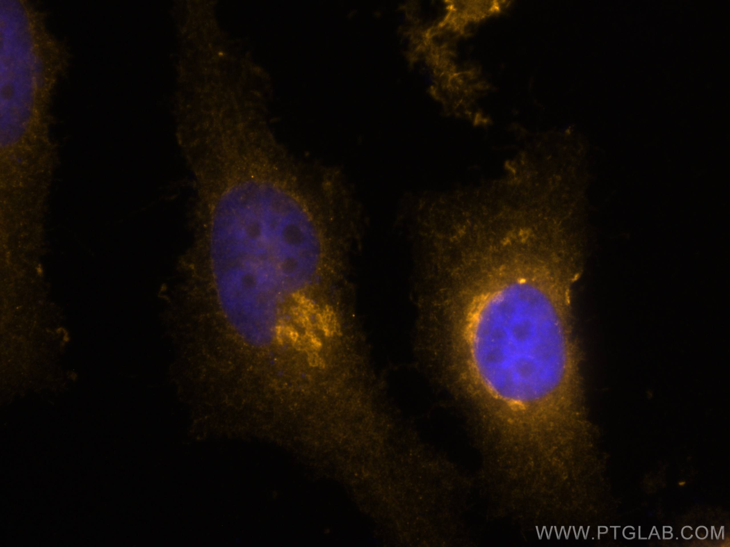 IF Staining of HeLa using CL555-16106