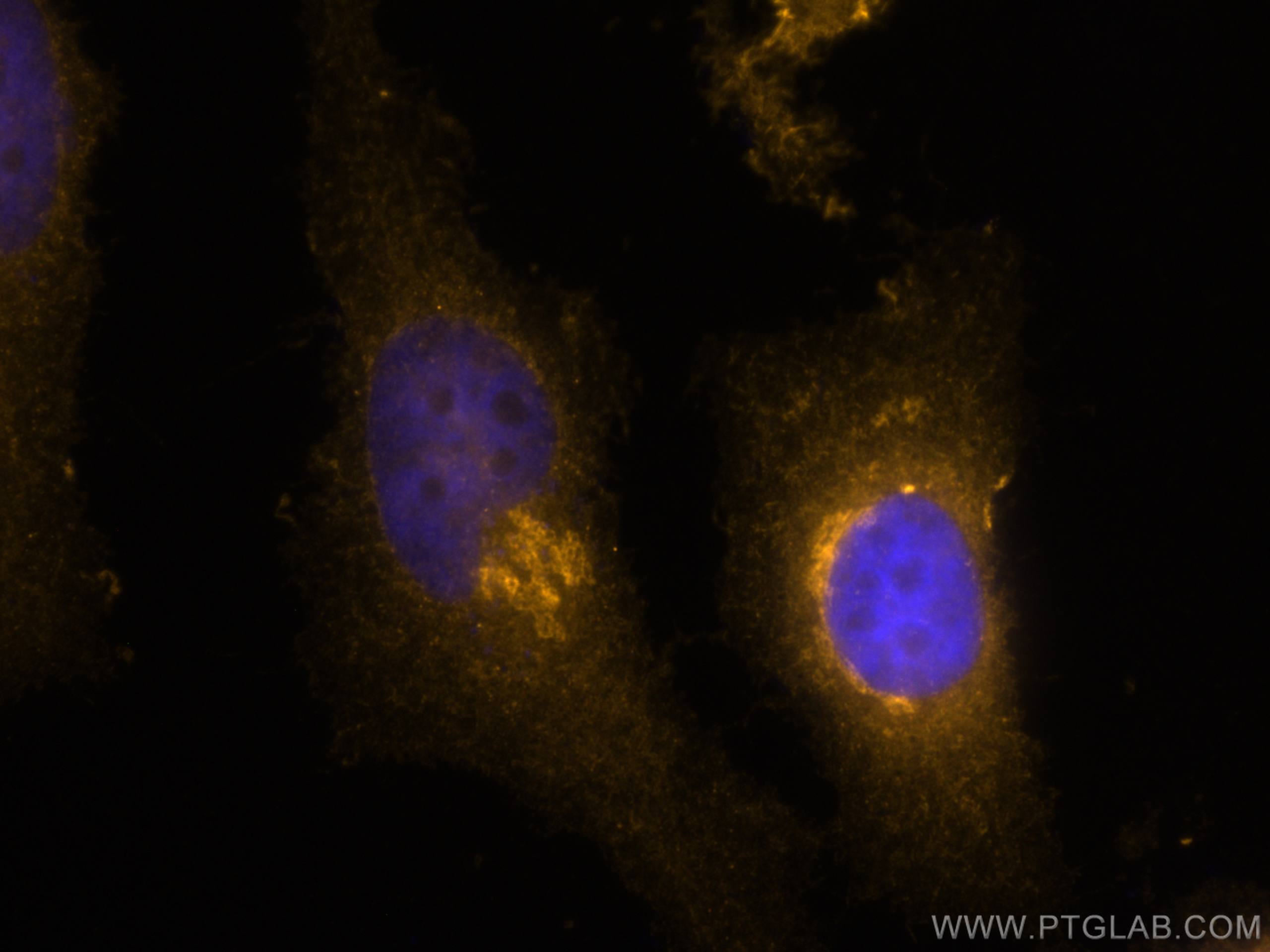 Immunofluorescence (IF) / fluorescent staining of HeLa cells using CoraLite®555-conjugated GS28 Polyclonal antibody (CL555-16106)