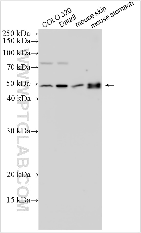Western Blot (WB) analysis of various lysates using GSDMA Polyclonal antibody (30354-1-AP)