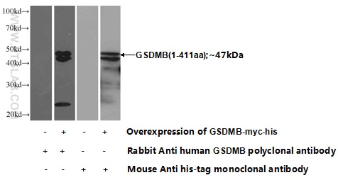 GSDMB Polyclonal antibody