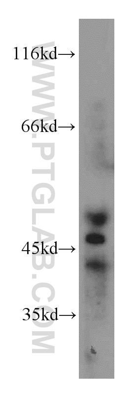 Western Blot (WB) analysis of COLO 320 cells using GSDMB Polyclonal antibody (12885-1-AP)