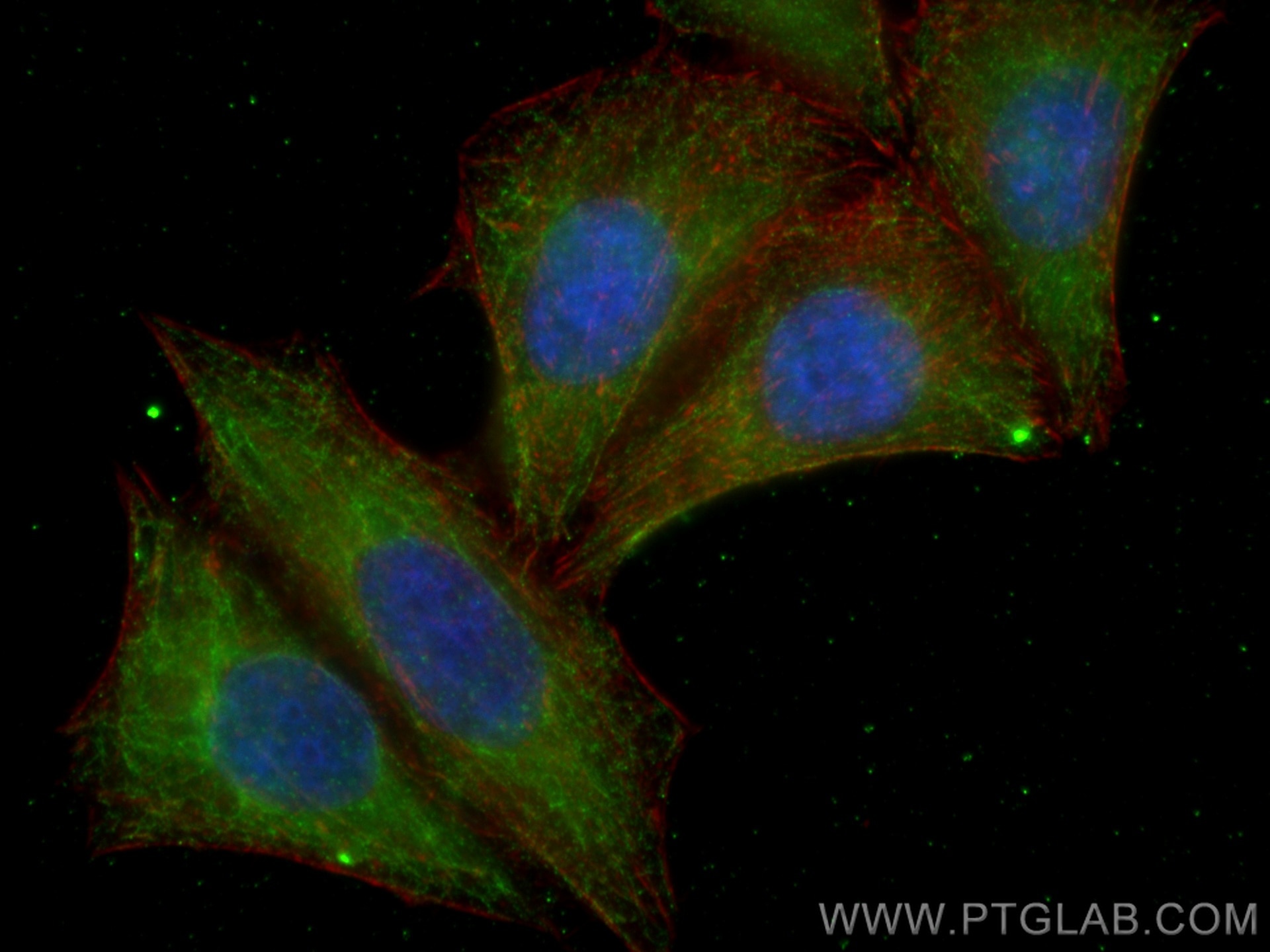 Immunofluorescence (IF) / fluorescent staining of HepG2 cells using GSDMB Monoclonal antibody (67527-1-Ig)