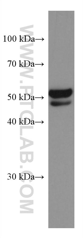 Western Blot (WB) analysis of COLO 320 cells using GSDMB Monoclonal antibody (67527-1-Ig)