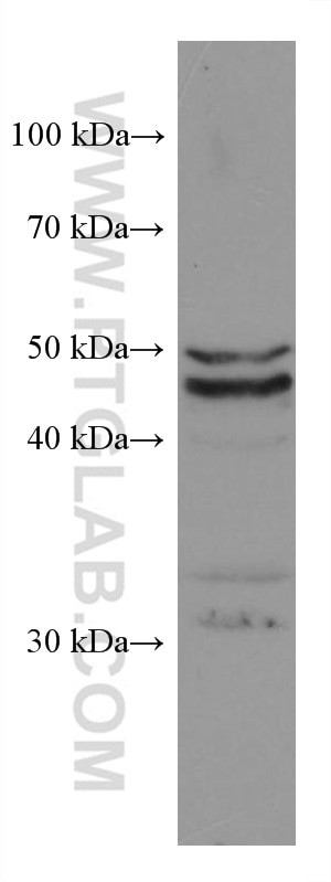 Western Blot (WB) analysis of PC-3 cells using GSDMB Monoclonal antibody (67527-1-Ig)