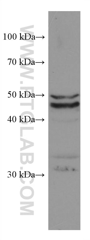 WB analysis of PC-3 using 67527-1-Ig