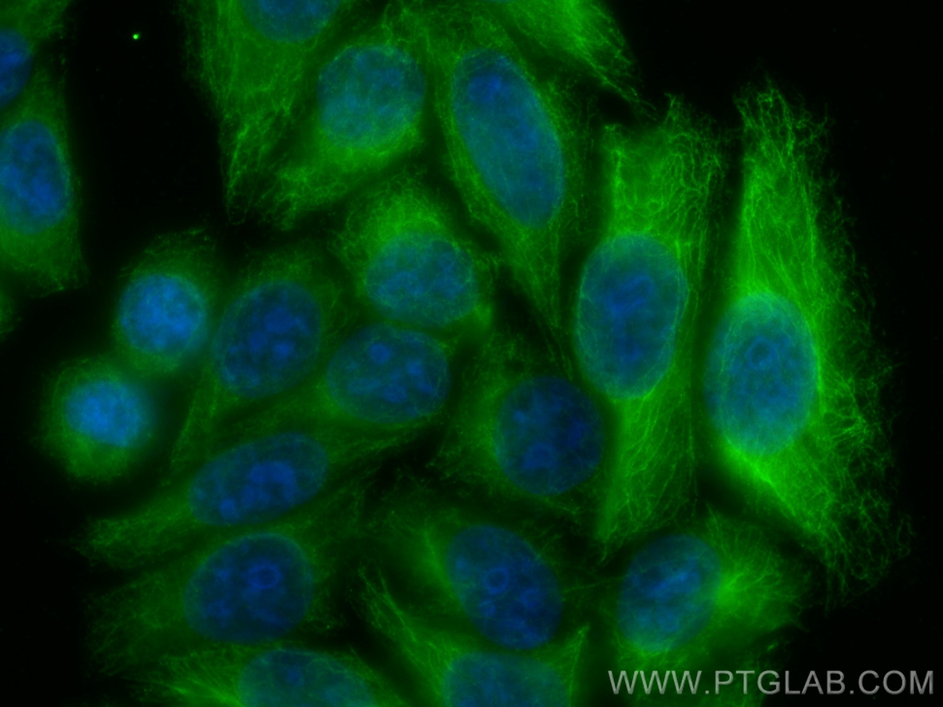 Immunofluorescence (IF) / fluorescent staining of HepG2 cells using CoraLite® Plus 488-conjugated GSDMB Monoclonal ant (CL488-67527)