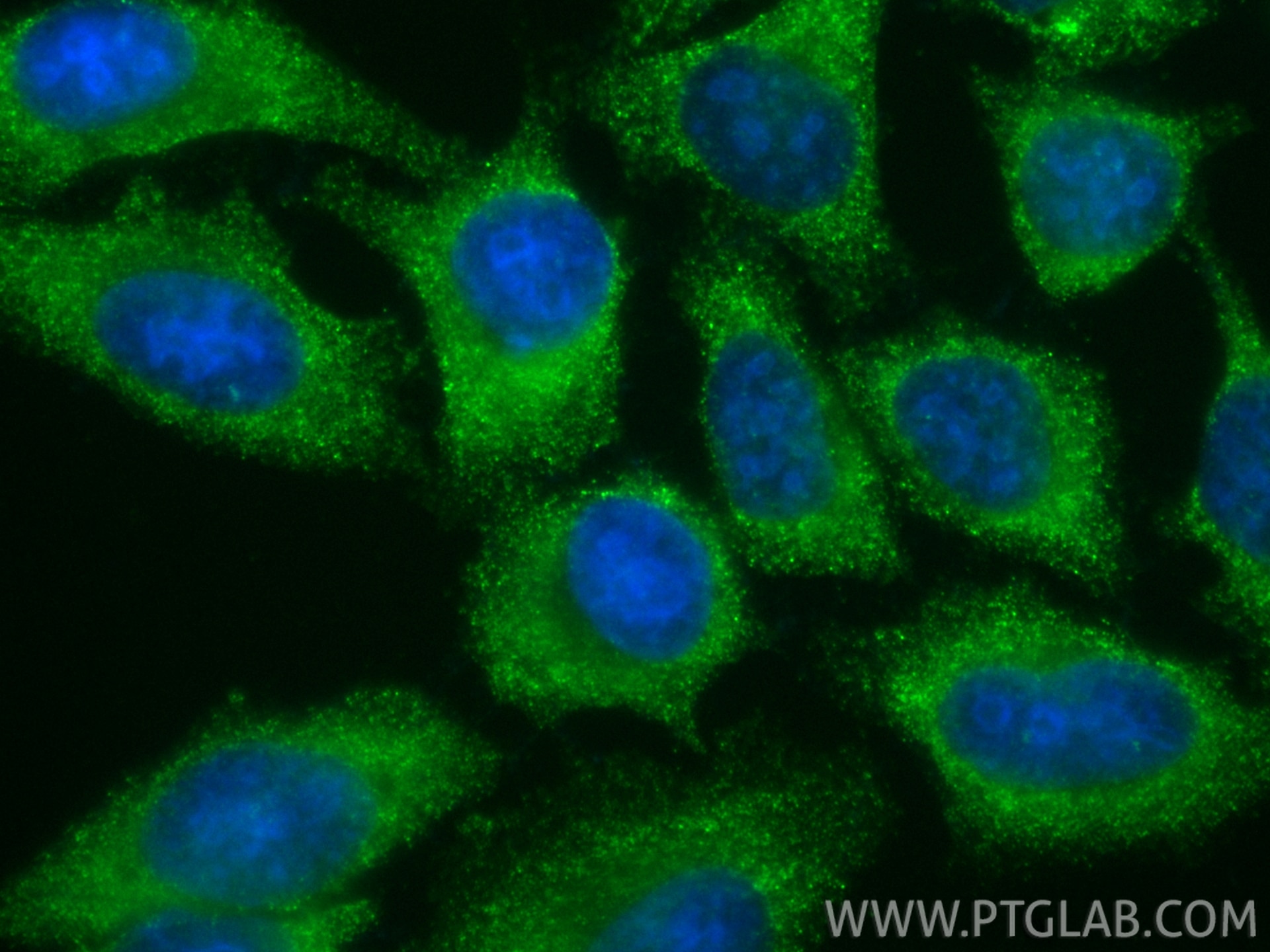 Immunofluorescent analysis of (-20°C Ethanol) fixed HepG2 cells using CoraLite® Plus 488 GSDMB antibody (CL488-67527, Clone: 2F12C4 ) at dilution of 1:200. Immunofluorescence (IF) / fluorescent staining of HepG2 cells using CoraLite® Plus 488-conjugated GSDMB Monoclonal ant (CL488-67527)