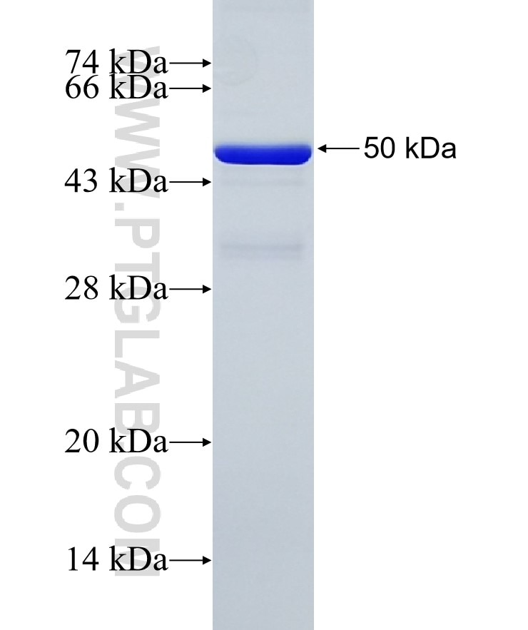GSDMB fusion protein Ag28332 SDS-PAGE