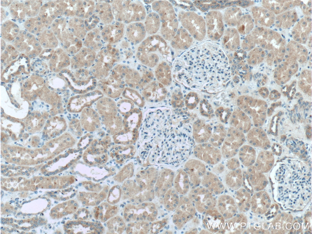Immunohistochemistry (IHC) staining of human kidney tissue using GSDMC Polyclonal antibody (27630-1-AP)