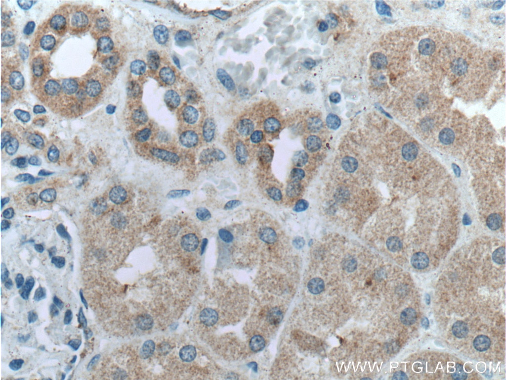 Immunohistochemistry (IHC) staining of human kidney tissue using GSDMC Polyclonal antibody (27630-1-AP)