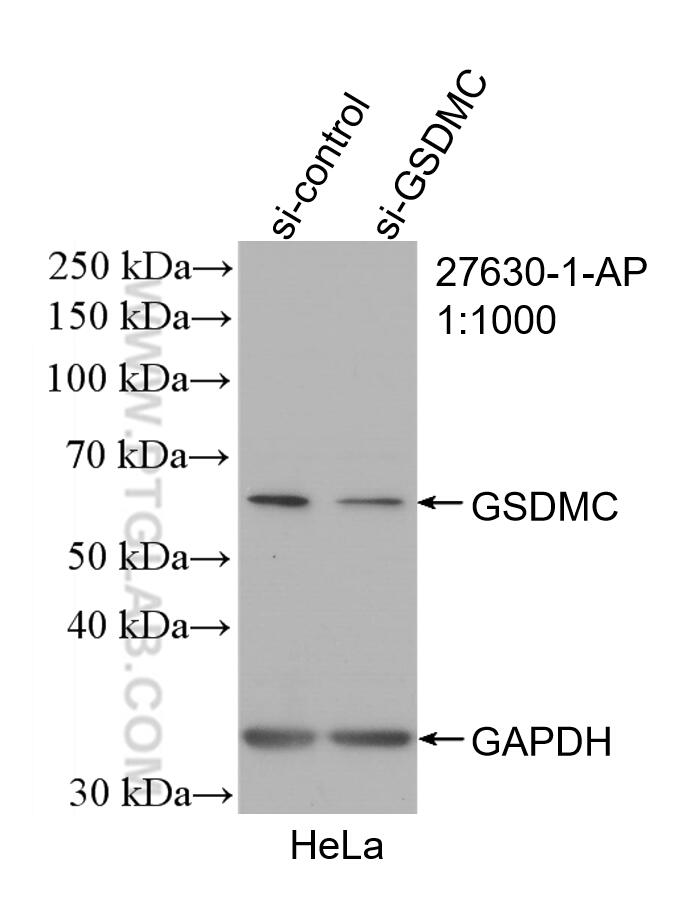 Western Blot (WB) analysis of HeLa cells using GSDMC Polyclonal antibody (27630-1-AP)