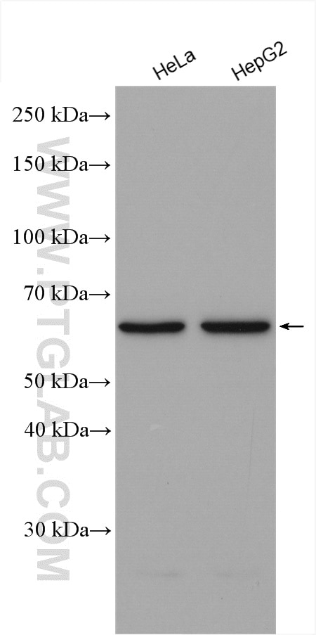 Western Blot (WB) analysis of various lysates using GSDMC Polyclonal antibody (27630-1-AP)