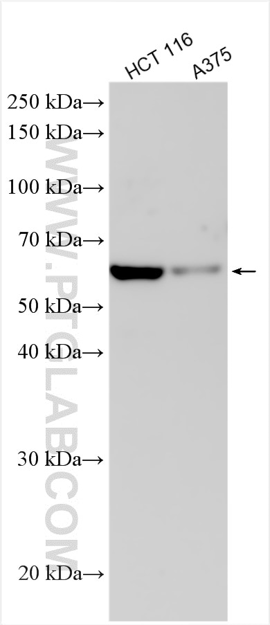 Western Blot (WB) analysis of various lysates using GSDMC Polyclonal antibody (30469-1-AP)