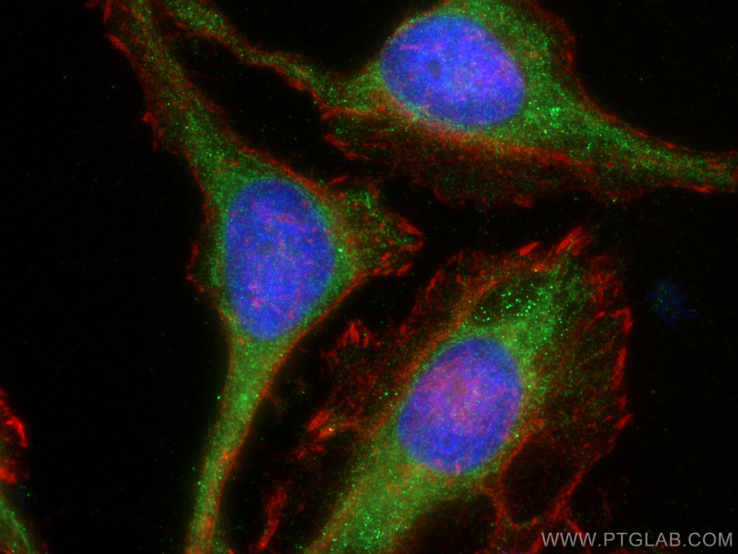 Immunofluorescence (IF) / fluorescent staining of HeLa cells using GSDMD  Polyclonal antibody (20770-1-AP)