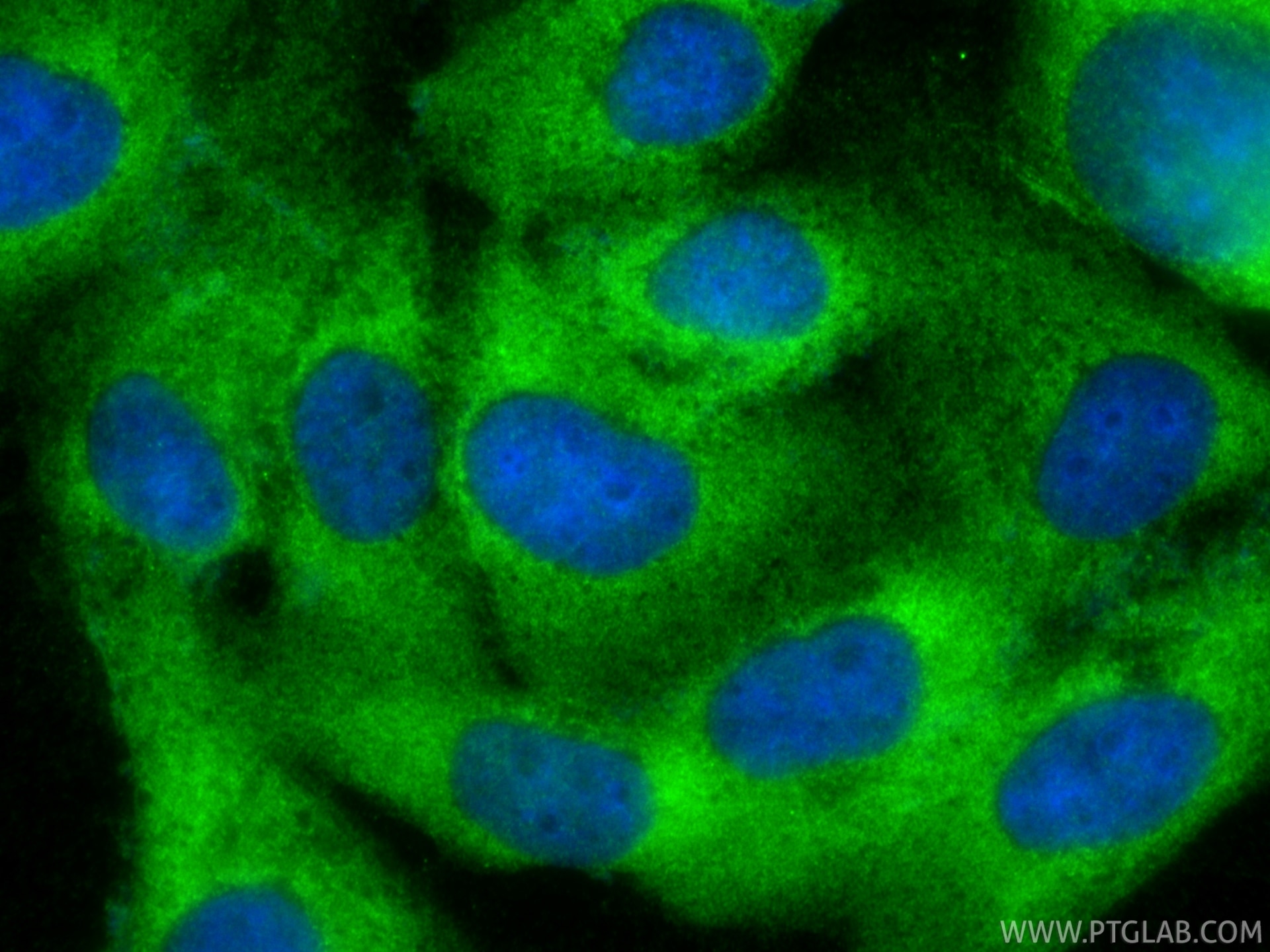 Immunofluorescence (IF) / fluorescent staining of A431 cells using GSDMD Polyclonal antibody (20770-1-AP)
