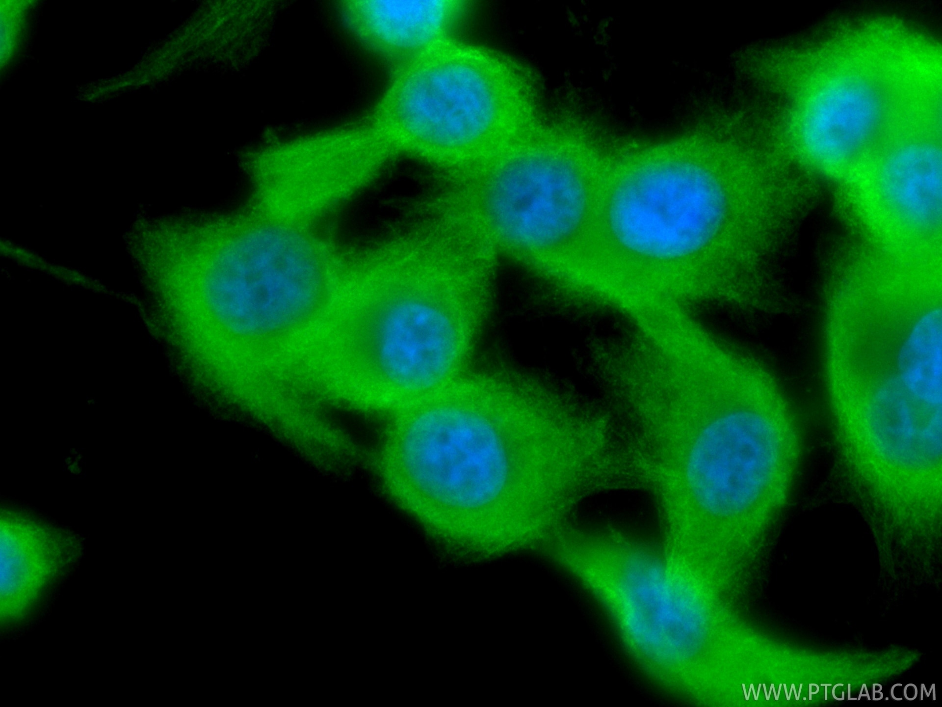 Immunofluorescence (IF) / fluorescent staining of PC-3 cells using GSDMD Polyclonal antibody (20770-1-AP)