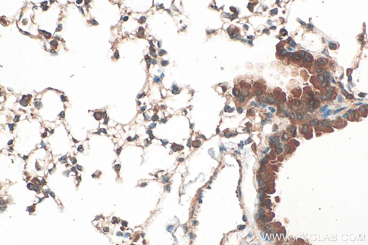 Immunohistochemistry (IHC) staining of mouse lung tissue using GSDMD Polyclonal antibody (20770-1-AP)