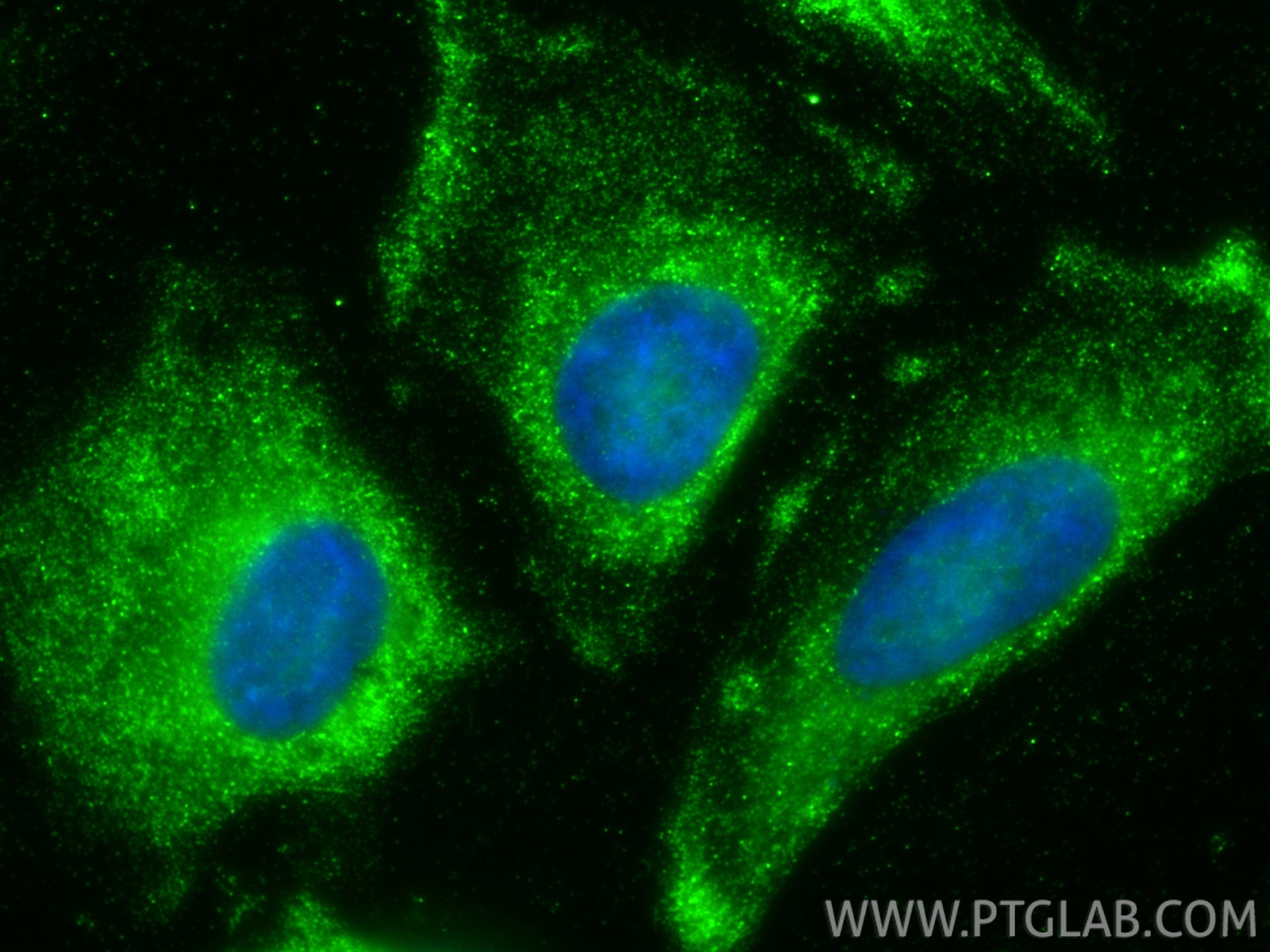 Immunofluorescence (IF) / fluorescent staining of HeLa cells using GSDMD Monoclonal antibody (66387-1-Ig)
