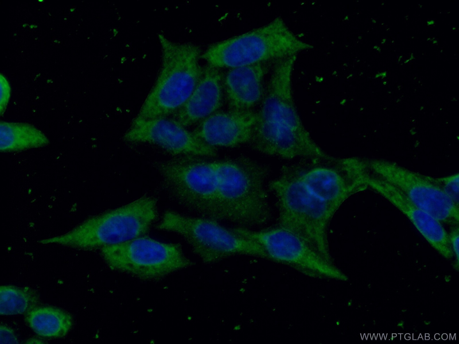 Immunofluorescence (IF) / fluorescent staining of HeLa cells using GSDMD Monoclonal antibody (66387-1-Ig)