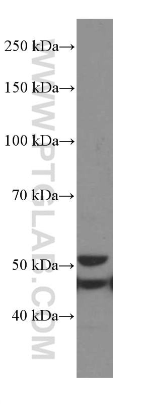 Western Blot (WB) analysis of COLO 320 cells using GSDMD Monoclonal antibody (66387-1-Ig)