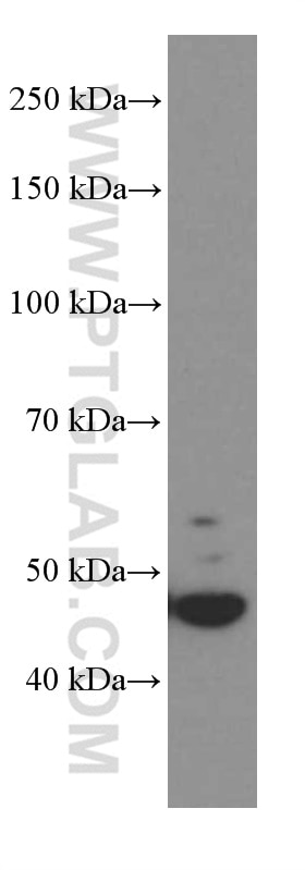 Western Blot (WB) analysis of human small intestine tissue using GSDMD Monoclonal antibody (66387-1-Ig)