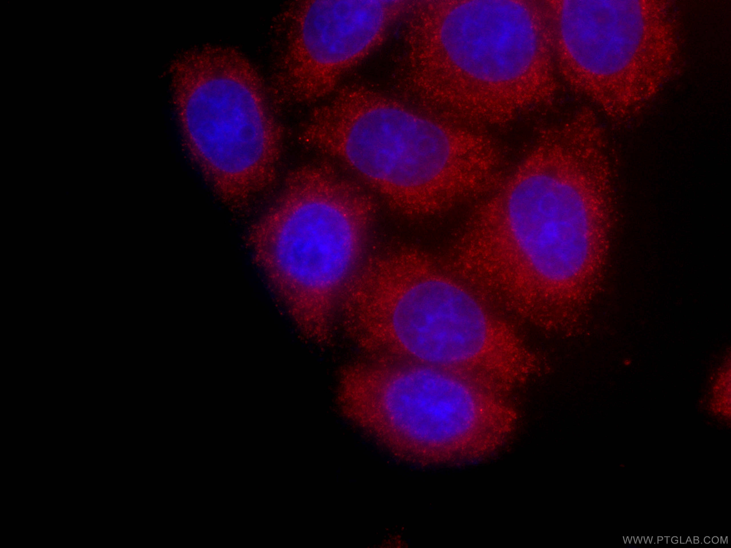 Immunofluorescence (IF) / fluorescent staining of HeLa cells using CoraLite®594-conjugated GSDMD Monoclonal antibody (CL594-66387)