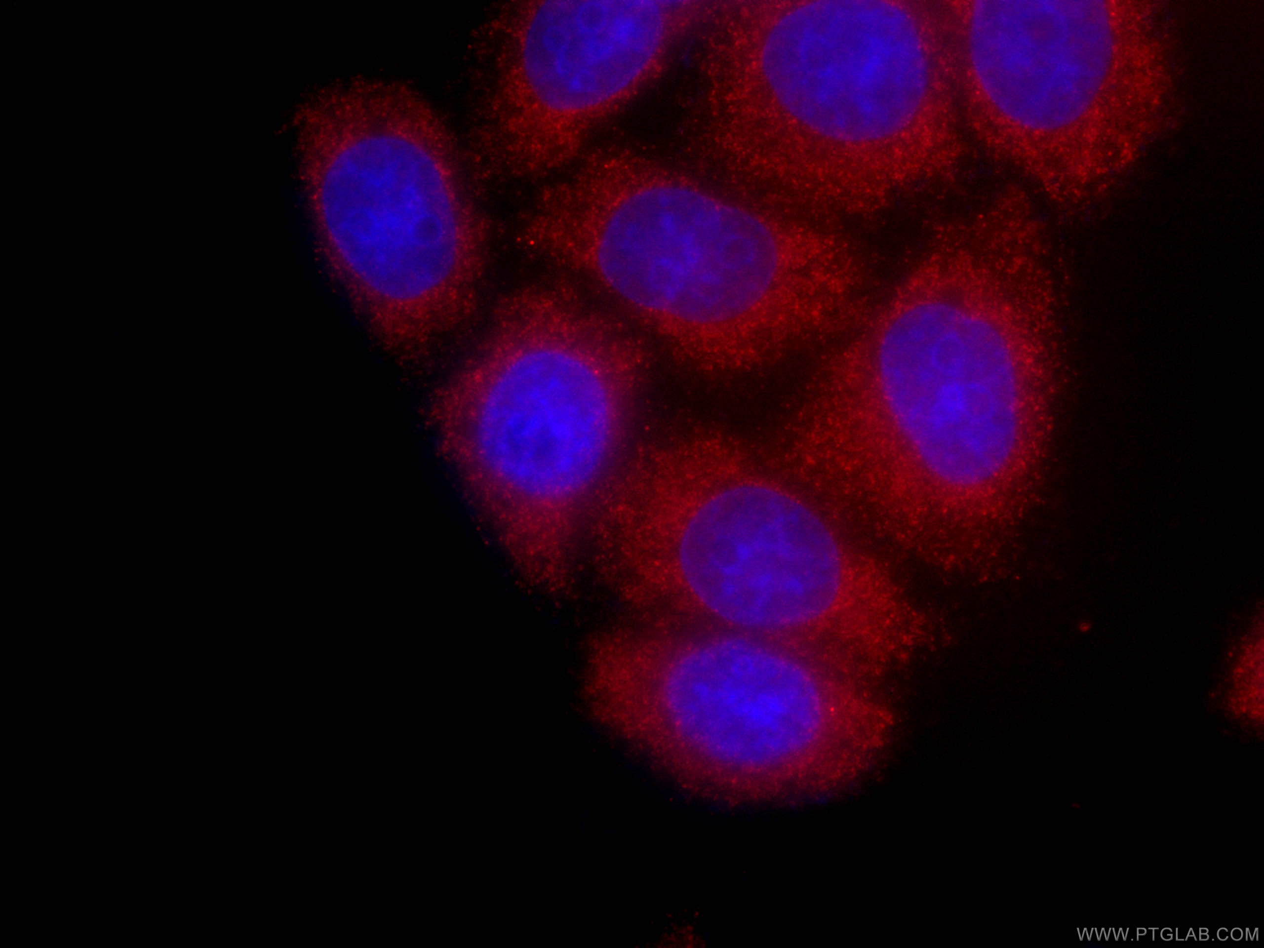 IF Staining of HeLa using CL594-66387