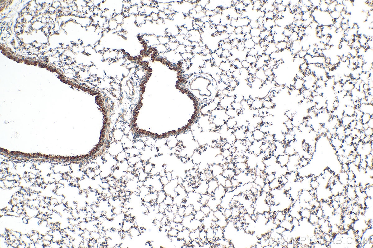 Immunohistochemistry (IHC) staining of mouse lung tissue using GSDMD Polyclonal antibody (30531-1-AP)