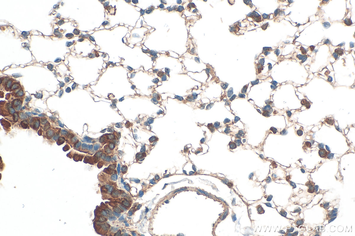 Immunohistochemistry (IHC) staining of mouse lung tissue using GSDMD Polyclonal antibody (30531-1-AP)