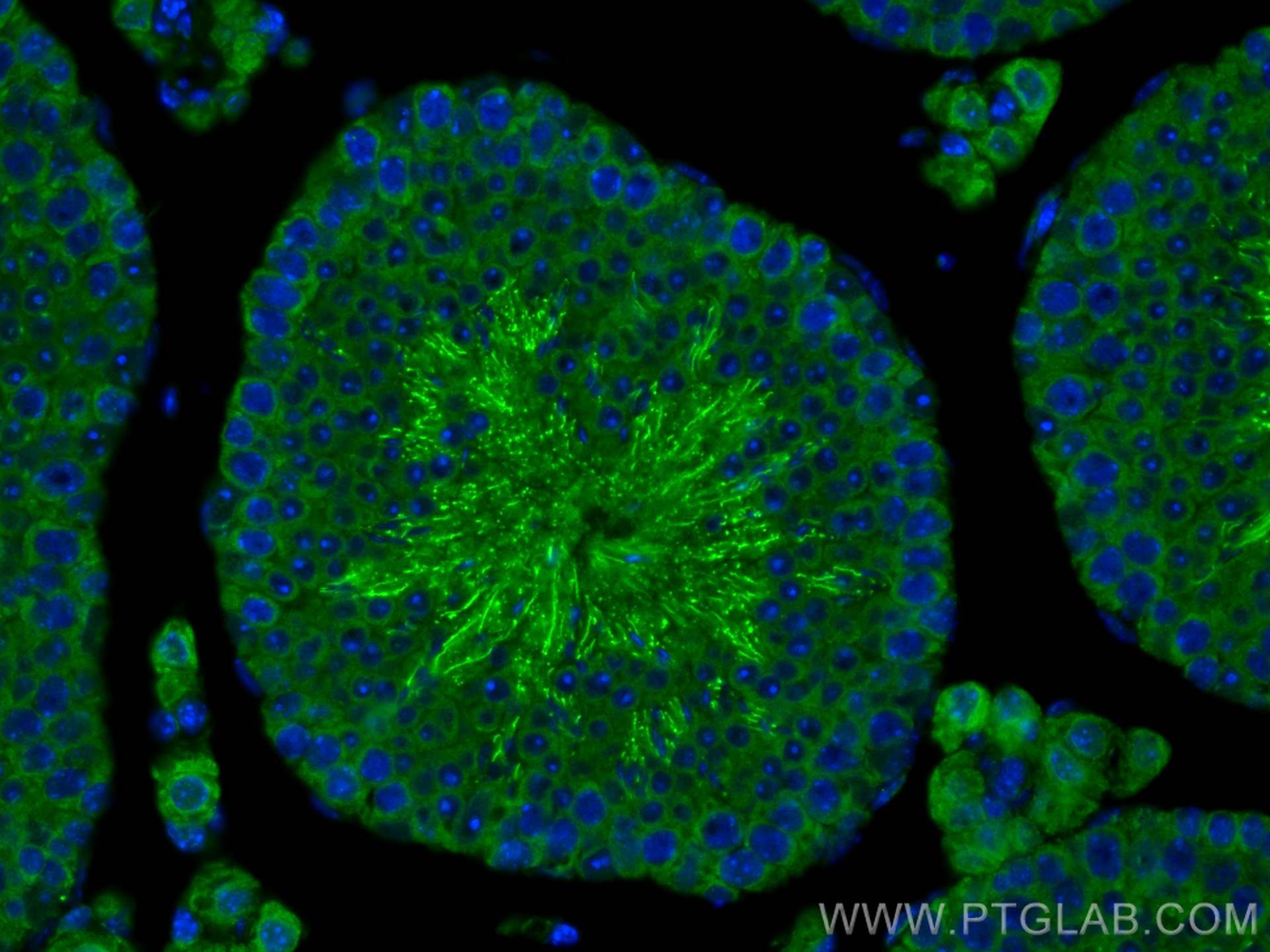 Immunofluorescence (IF) / fluorescent staining of mouse testis tissue using GSG1 Polyclonal antibody (15258-1-AP)