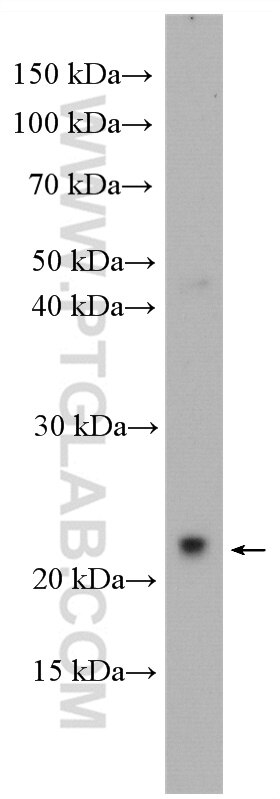 Western Blot (WB) analysis of U-251 cells using GSG1L Polyclonal antibody (17328-1-AP)