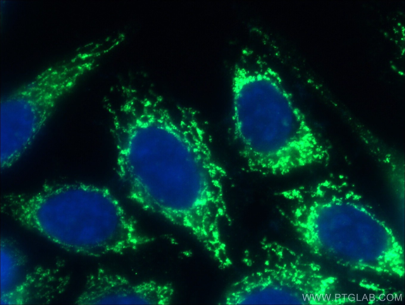 Immunofluorescence (IF) / fluorescent staining of HepG2 cells using GSK3A Polyclonal antibody (13419-1-AP)