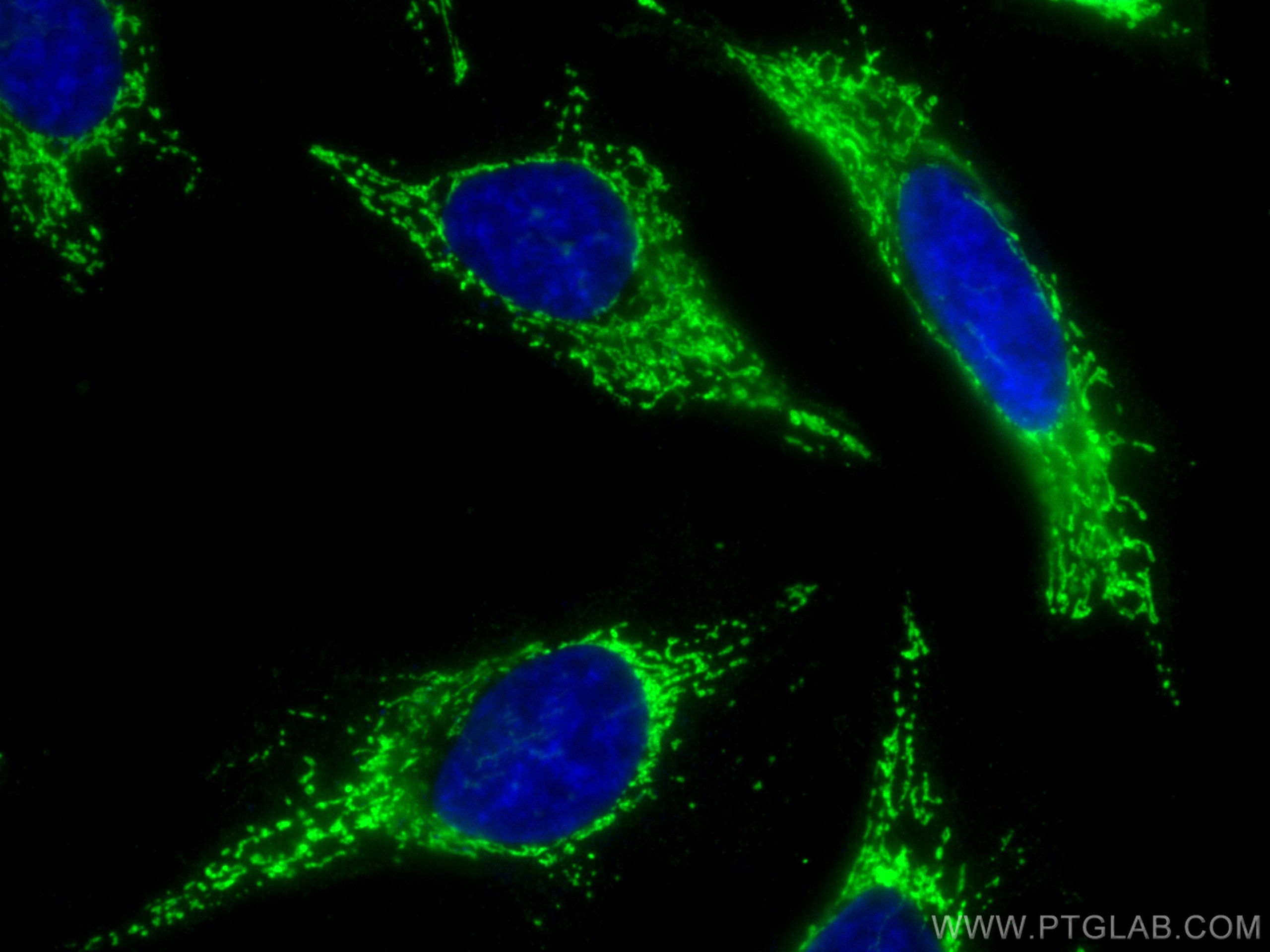 Immunofluorescence (IF) / fluorescent staining of HeLa cells using GSK3A Polyclonal antibody (13419-1-AP)