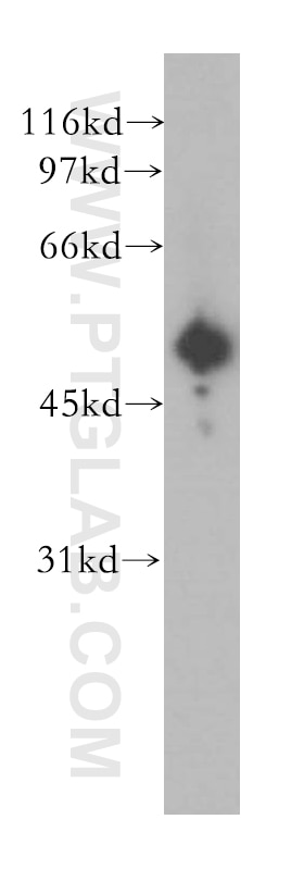 Western Blot (WB) analysis of human plasma using GSK3A Polyclonal antibody (13419-1-AP)