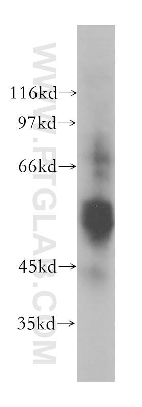 Western Blot (WB) analysis of mouse liver tissue using GSK3A Polyclonal antibody (13419-1-AP)