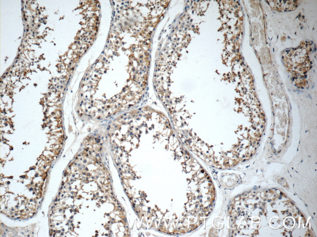 Immunohistochemistry (IHC) staining of human testis tissue using GSK3B Polyclonal antibody (15113-1-AP)