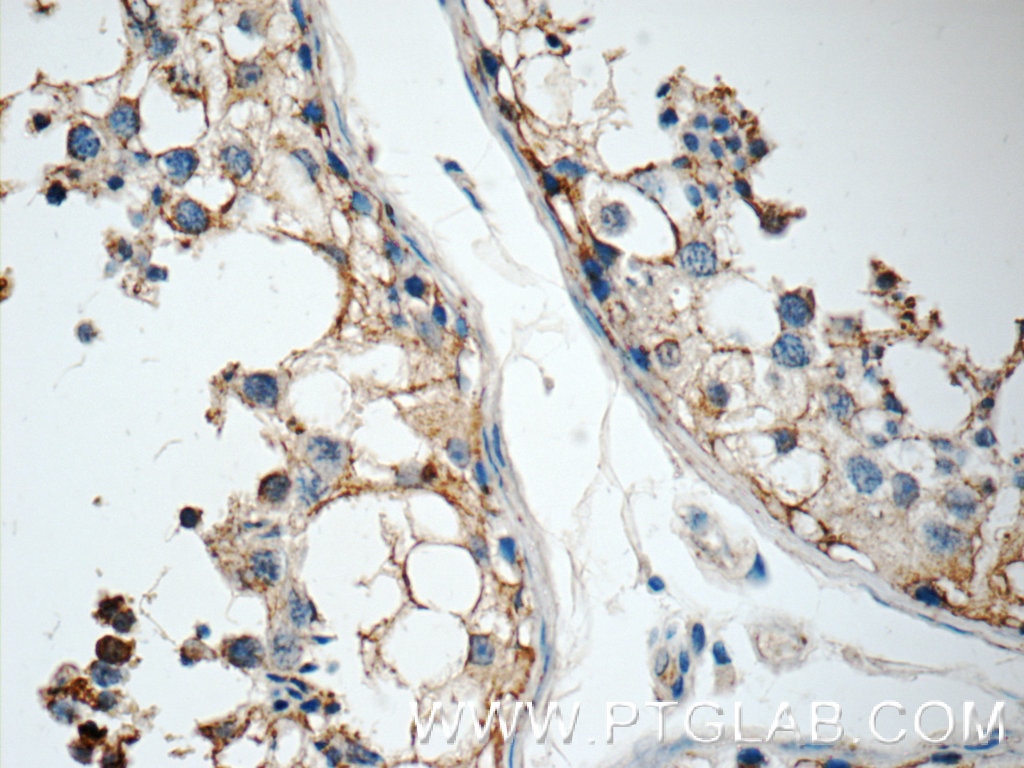 Immunohistochemistry (IHC) staining of human testis tissue using GSK3B Polyclonal antibody (15113-1-AP)