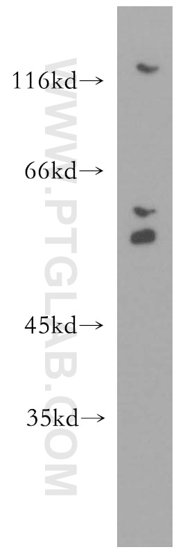 Western Blot (WB) analysis of HEK-293 cells using GSK3B Polyclonal antibody (15113-1-AP)