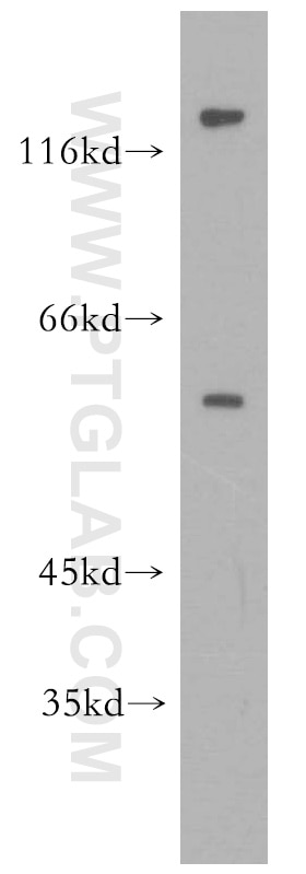 WB analysis of mouse ovary using 15113-1-AP