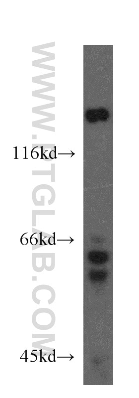 Western Blot (WB) analysis of HeLa cells using GSK3B Polyclonal antibody (15113-1-AP)