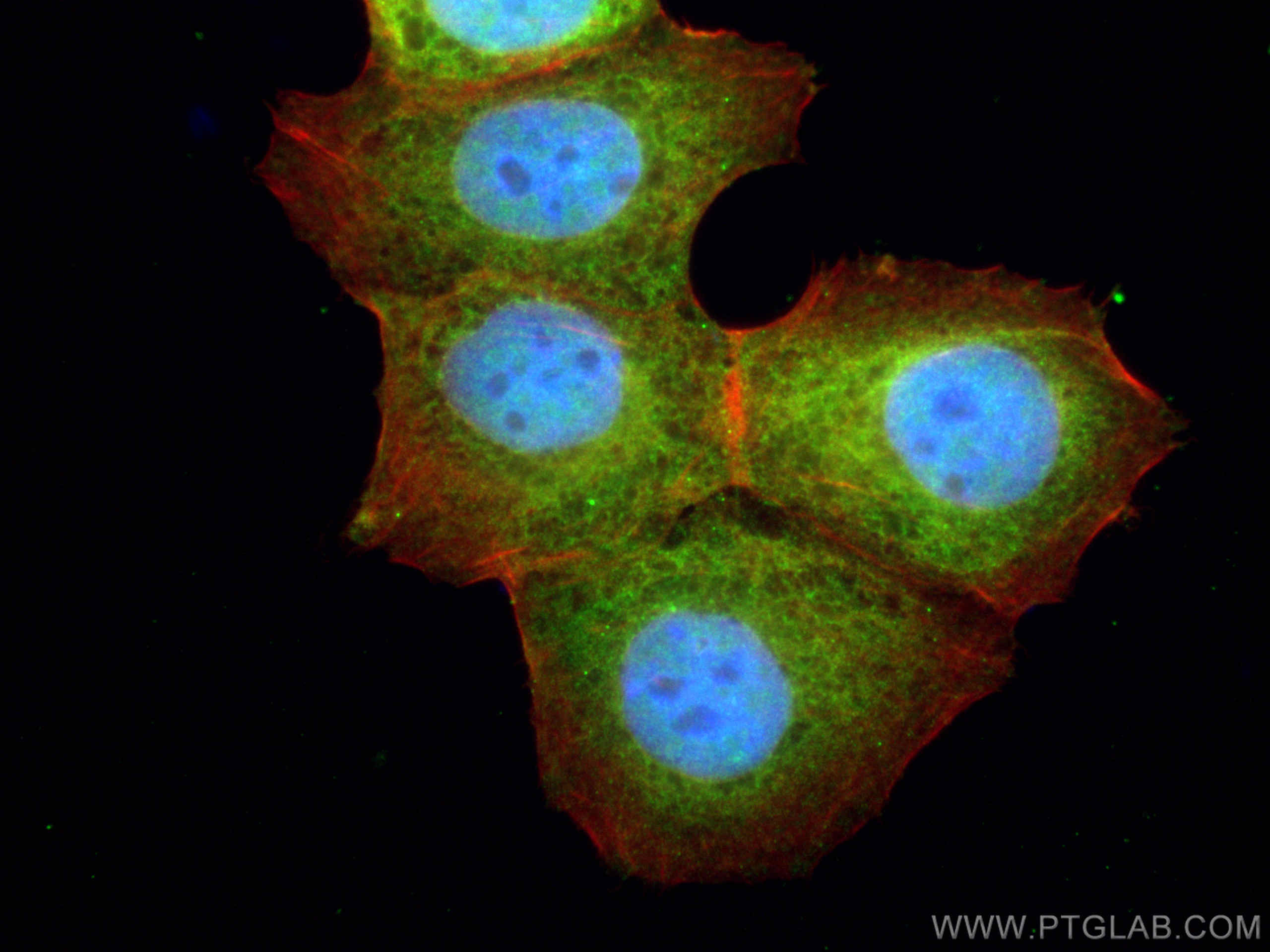 Immunofluorescence (IF) / fluorescent staining of MCF-7 cells using GSK3B Polyclonal antibody (22104-1-AP)