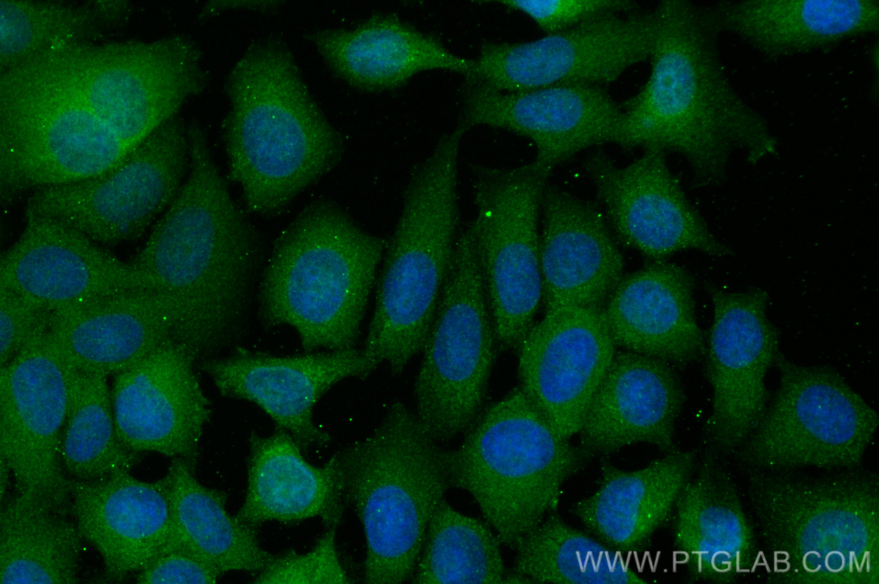 Immunofluorescence (IF) / fluorescent staining of MCF-7 cells using GSK3B Polyclonal antibody (22104-1-AP)