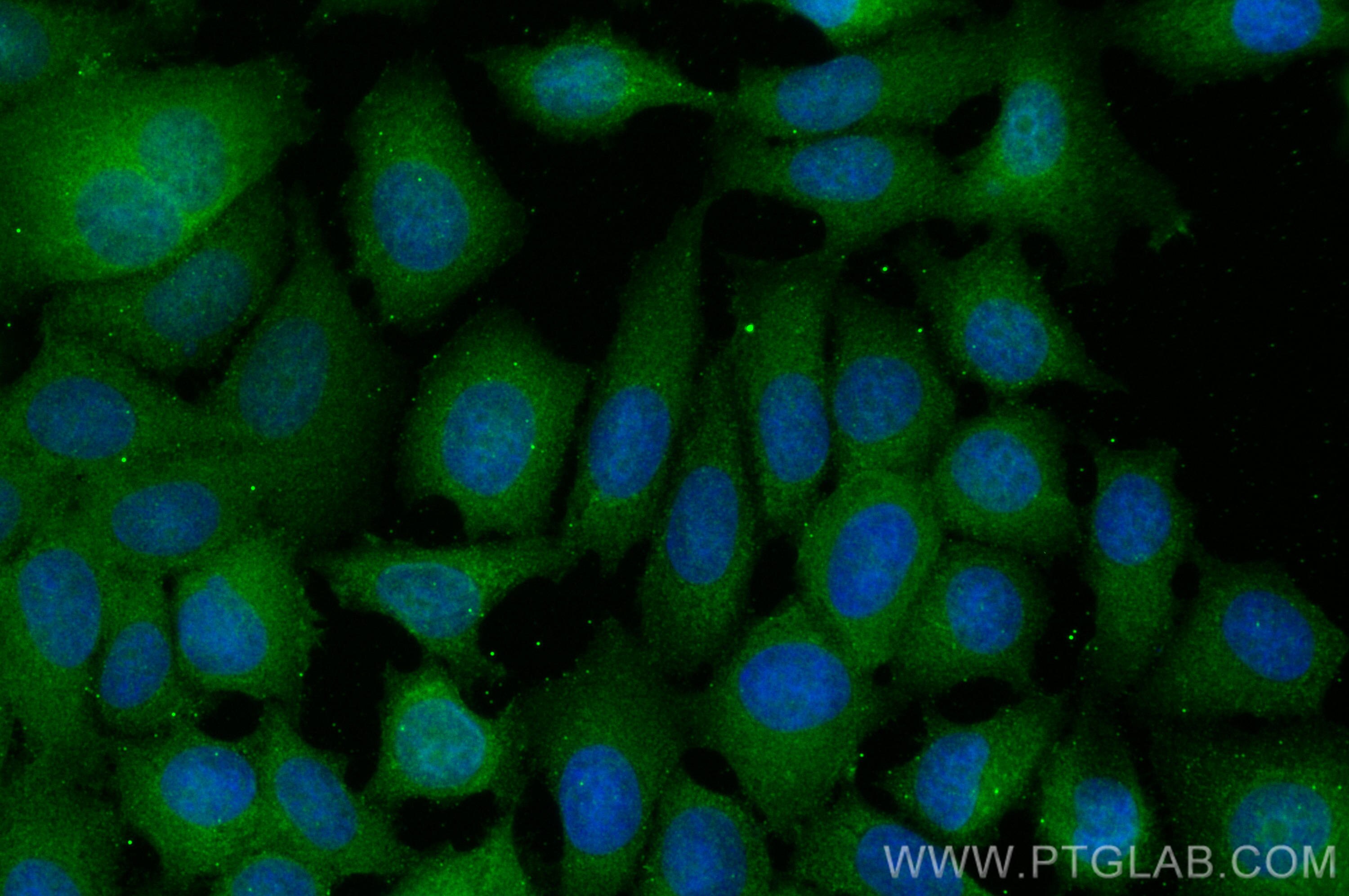 IF Staining of MCF-7 using 22104-1-AP