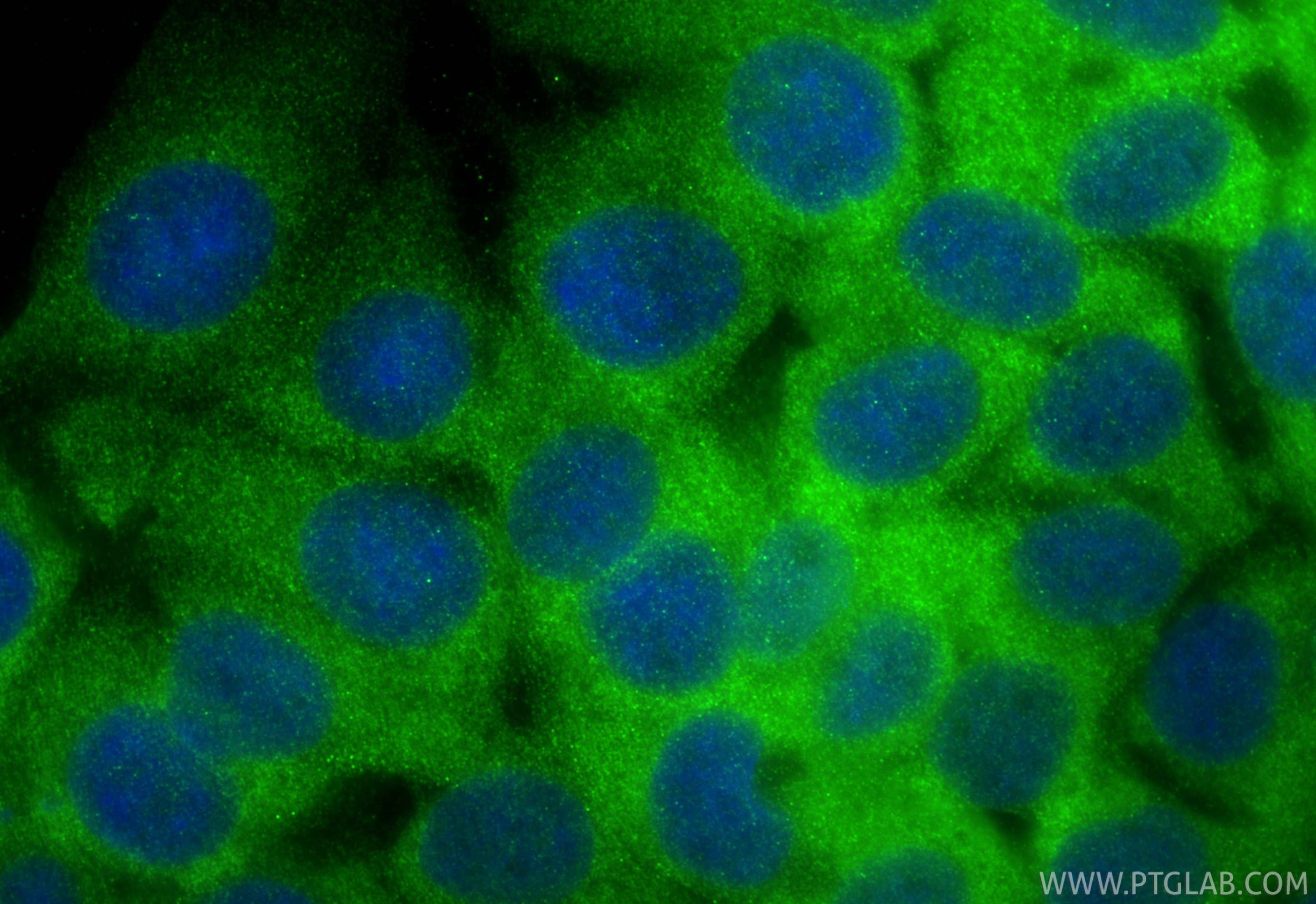 Immunofluorescence (IF) / fluorescent staining of MCF-7 cells using GSK3B Polyclonal antibody (22104-1-AP)